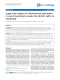 Báo cáo y học: " Large-scale analysis of chromosomal aberrations in cancer karyotypes reveals two distinct paths to aneuploidy"