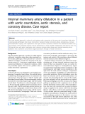 Báo cáo y học: "Internal mammary artery dilatation in a patient with aortic coarctation, aortic stenosis, and coronary disease. Case report"