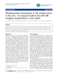 Báo cáo y học: "Fibrolipomatous hamartoma in the median nerve in the arm - an unusual location but with MR imaging characteristics: a case report"