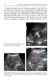 Manual of Diagnostic Ultrasound in Infectious Tropical Diseases - part 4