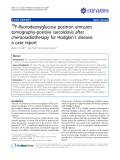 Báo cáo y học: "F-fluorodeoxyglucose positron emission tomography-positive sarcoidosis after chemoradiotherapy for Hodgkin’s disease: a case report."