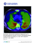 Báo cáo khoa học: "Pulmonary intravascular lymphoma diagnosed by 18fluorodeoxyglucose positron emission tomography-guided transbronchial lung biopsy in a man with long-term survival: a case report"