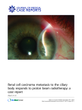 Báo cáo y học: " Renal cell carcinoma metastasis to the ciliary body responds to proton beam radiotherapy: a case report"