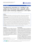 Báo cáo y học: " Toxoplasmosis presenting as a swelling in the axillary tail of the breast and a palpable axillary lymph node mimicking malignancy: a case report"