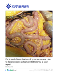 Báo cáo y học: " Peritoneal dissemination of prostate cancer due to laparoscopic radical prostatectomy: a case report"