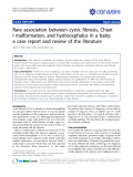 Báo cáo y học: "Rare association between cystic fibrosis, Chiari I malformation, and hydrocephalus in a baby: a case report and review of the literature"