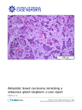 báo cáo khoa học: "Metastatic breast carcinoma mimicking a sebaceous gland neoplasm: a case report"