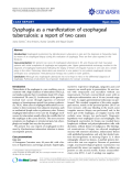 báo cáo khoa học: "Dysphagia as a manifestation of esophageal tuberculosis: a report of two cases"