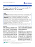 báo cáo khoa học: "Changes in physiological tremor associated with an epileptic seizure: a case report"