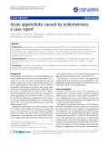 Báo cáo y học: "Acute appendicitis caused by endometriosis: a case report"