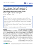 Báo cáo y học: " Early finding of chest wall metastasis of hepatocellular carcinoma in a woman by fluorodeoxyglucose-positron emission tomography scan: a case report"