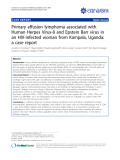 Báo cáo y học: "Primary effusion lymphoma associated with Human Herpes Virus-8 and Epstein Barr virus in an HIV-infected woman from Kampala, Uganda: a case repor"