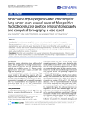 Báo cáo y học: " Treatment of stasis dermatitis using aminaphtone: Bronchial stump aspergillosis after lobectomy for lung cancer as an unusual cause of false positive fluorodeoxyglucose positron emission tomography and computed tomography: a case report."