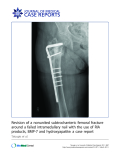 Báo cáo y học: ":  Revision of a nonunited subtrochanteric femoral fracture around a failed intramedullary nail with the use of RIA products, BM"