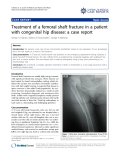 Báo cáo y học: "Treatment of a femoral shaft fracture in a patient with congenital hip disease: a case report"