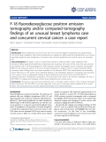 Báo cáo y học: "F-18 fluorodeoxyglucose positron emission tomography and/or computed tomography findings of an unusual breast lymphoma case and concurrent cervical cancer: a case report"