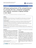 Báo cáo y học: "Soft-tissue perineurioma of the retroperitoneum in a 63-year-old man, computed tomography and magnetic resonance imaging findings: a case report"