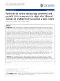 báo cáo khoa học: "Remission of severe restless legs syndrome and periodic limb movements in sleep after bilateral excision of multiple foot neuromas: a case report"