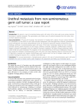 báo cáo khoa học: " Urethral metastasis from non-seminomatous germ cell tumor: a case report"