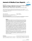 Báo cáo khoa hoc:"   Seizures as the first manifestation of chromosome 22q11.2 deletion syndrome in a 40-year old man: a case report"