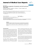 Báo cáo khoa hoc:"  Spontaneous regression of metastatic renal cell carcinoma: case report"