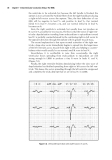 Twelve-Lead Electrocardiography - part 4