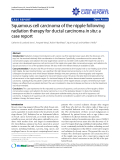 Báo cáo y học: "Squamous cell carcinoma of the nipple following radiation therapy for ductal carcinoma in situ: a case report"