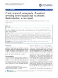 Báo cáo y học: "Chest computed tomography of a patient revealing severe hypoxia due to amniotic fluid embolism: a case repor"