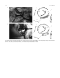 Craniomaxillofacial Reconstructive and Corrective Bone Surgery - part 10
