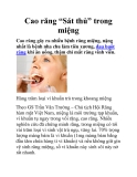 Cao răng “Sát thủ” trong miệng