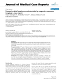 Báo cáo y học: " Unusual orbital lymphoma undetectable by magnetic resonance imaging: a case report"