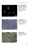 Atlas de poche de microbiologiel - part 9