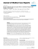 Báo cáo y học: "A new method in thoracoscopic inferior mediastinal lymph node biopsy: a case report"