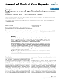 Báo cáo y học: " Laugh syncope as a rare sub-type of the situational syncopes: a case report"