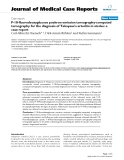 Báo cáo y học: "F-18-fluorodeoxyglucose positron emission tomography-computed tomography for the diagnosis of Takayasu's arteritis in stroke: a case report"