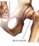 Đặc điểm Chấn thương cơ xương