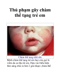 Thủ phạm gây chàm thể tạng trẻ em