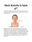 Bệnh Rubella là bệnh gì?