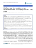 báo cáo hóa học:"   Metal on metal hip resurfacing versus uncemented custom total hip replacement - early results"