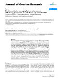 báo cáo hóa học:"   Positron emission tomography in ovarian cancer: 18F-deoxy-glucose and 16α-18F-fluoro-17β-estradiol PET"