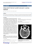 báo cáo hóa học: " Intracranial internal carotid aneurysm causing diplopia"
