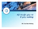 Kỹ thuật gây tê ổ gãy xương 