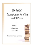 ECG FOR MRCP TEACHING NOTES AND BEST OF FIVES WITH ECG PICTURES