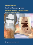 Beat Hintermann Total Ankle Arthroplasty Historical Overview, Current Concepts and Future Perspectives