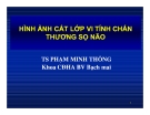 HÌNH ẢNH CẮT LỚP VI TÍNH CHẤN THƯƠNG SỌ NÃO