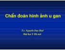 Chuẩn đoán hình ảnh u gan