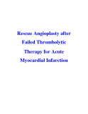 Rescue Angioplasty after Failed Thrombolytic Therapy for Acute Myocardial Infarction