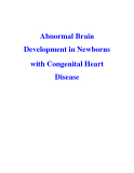 Abnormal Brain Development in Newborns with Congenital Heart Disease