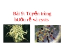 Tuyến trùng bướu rễ và cysts