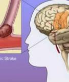 Di chứng tai biến mạch máu não ở người cao tuổi